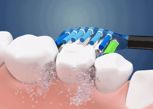 電動牙刷如何選擇 全方位指南，助力牙齒清潔健康